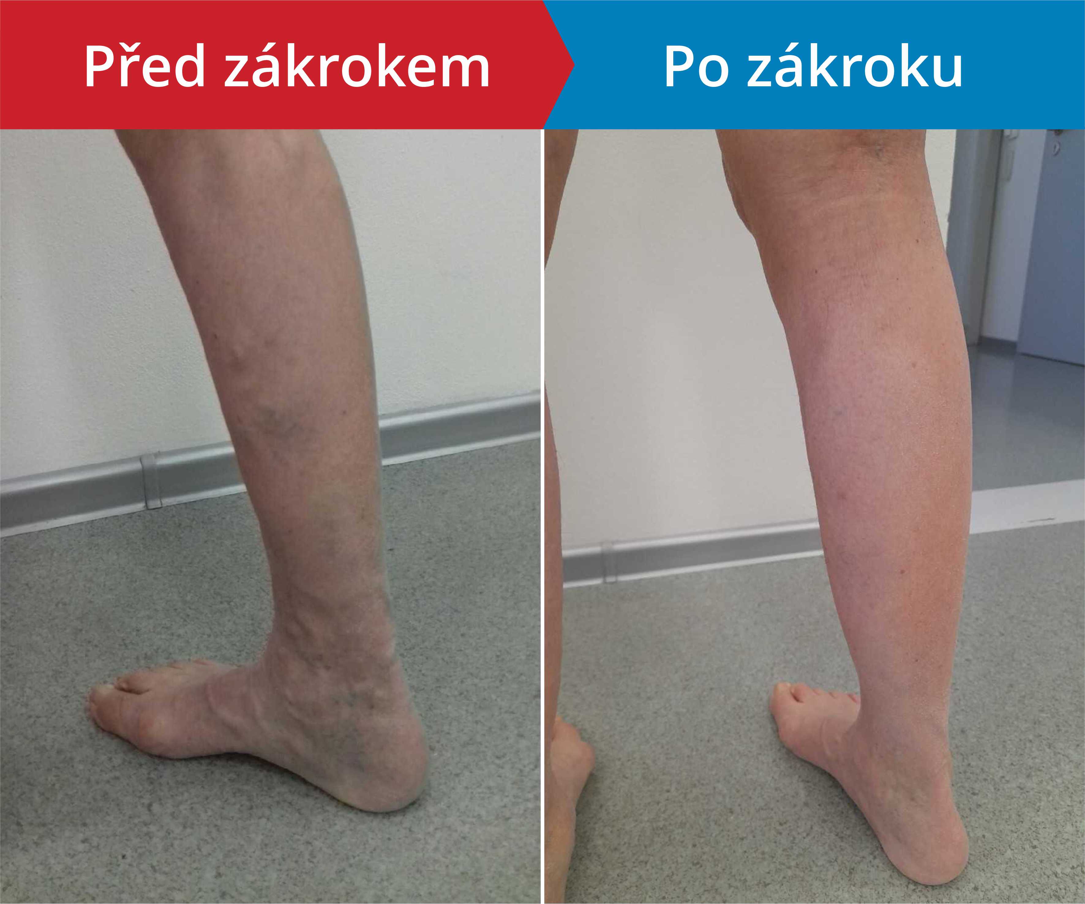 Načítám foto