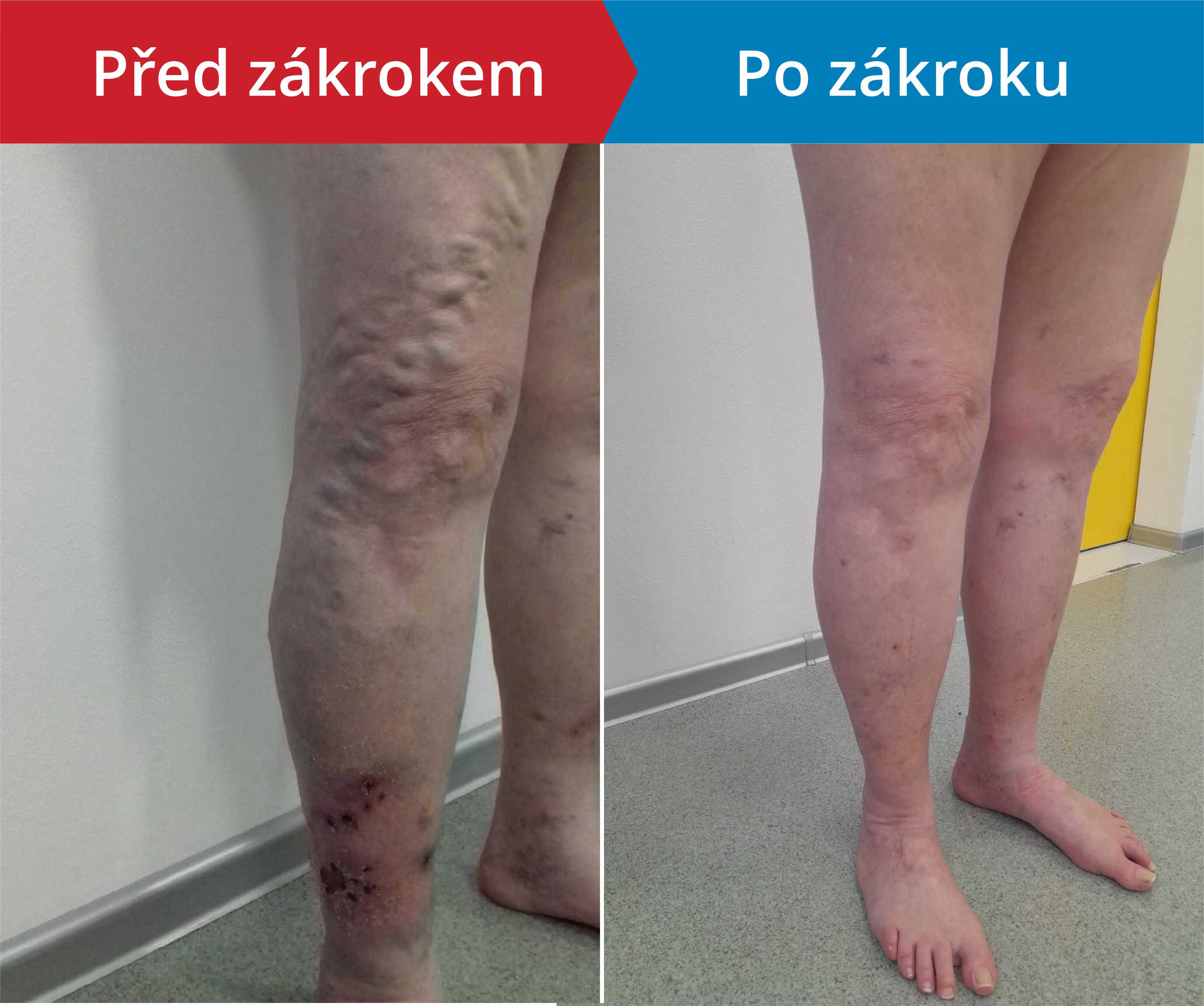 Načítám foto