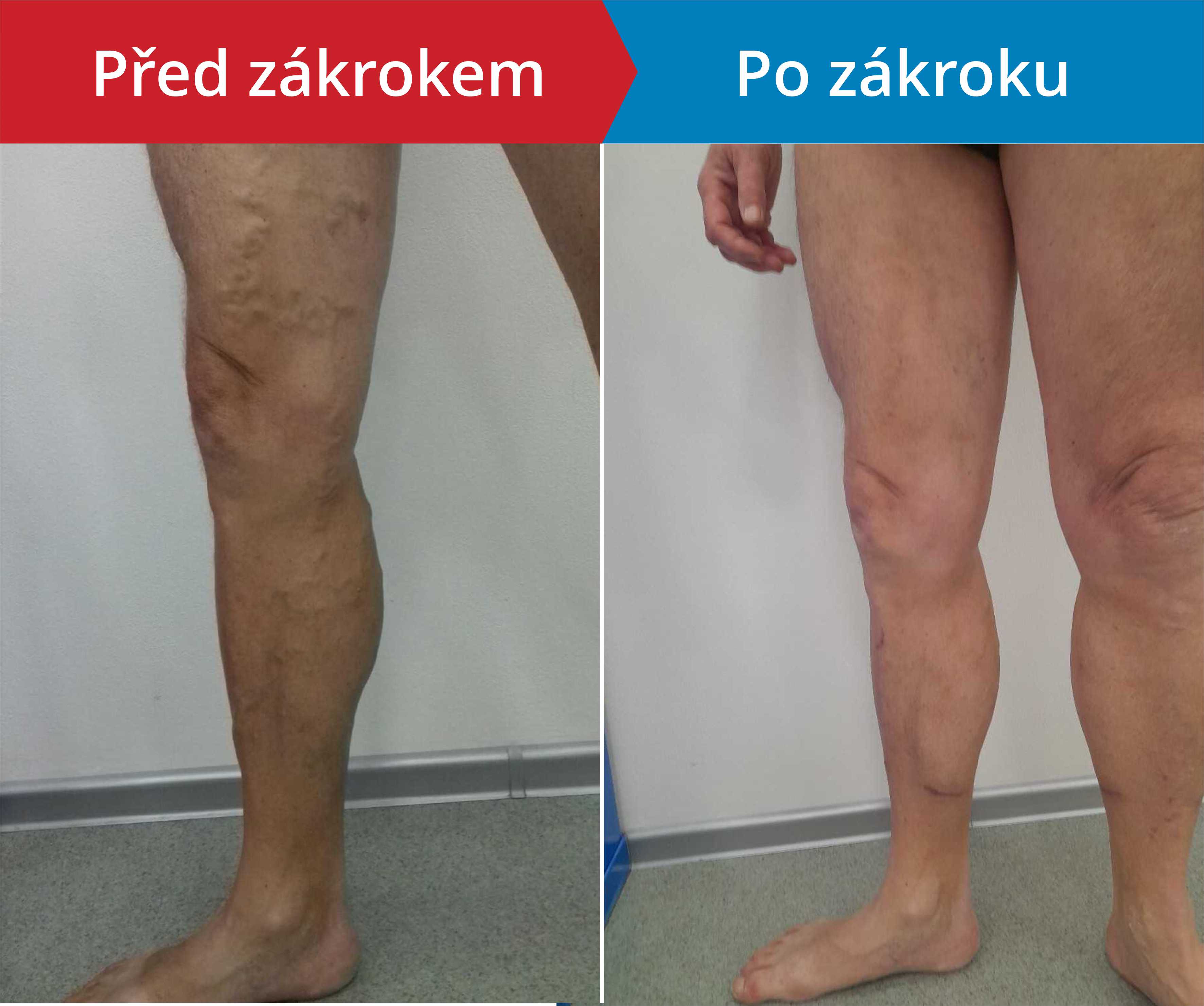Načítám foto