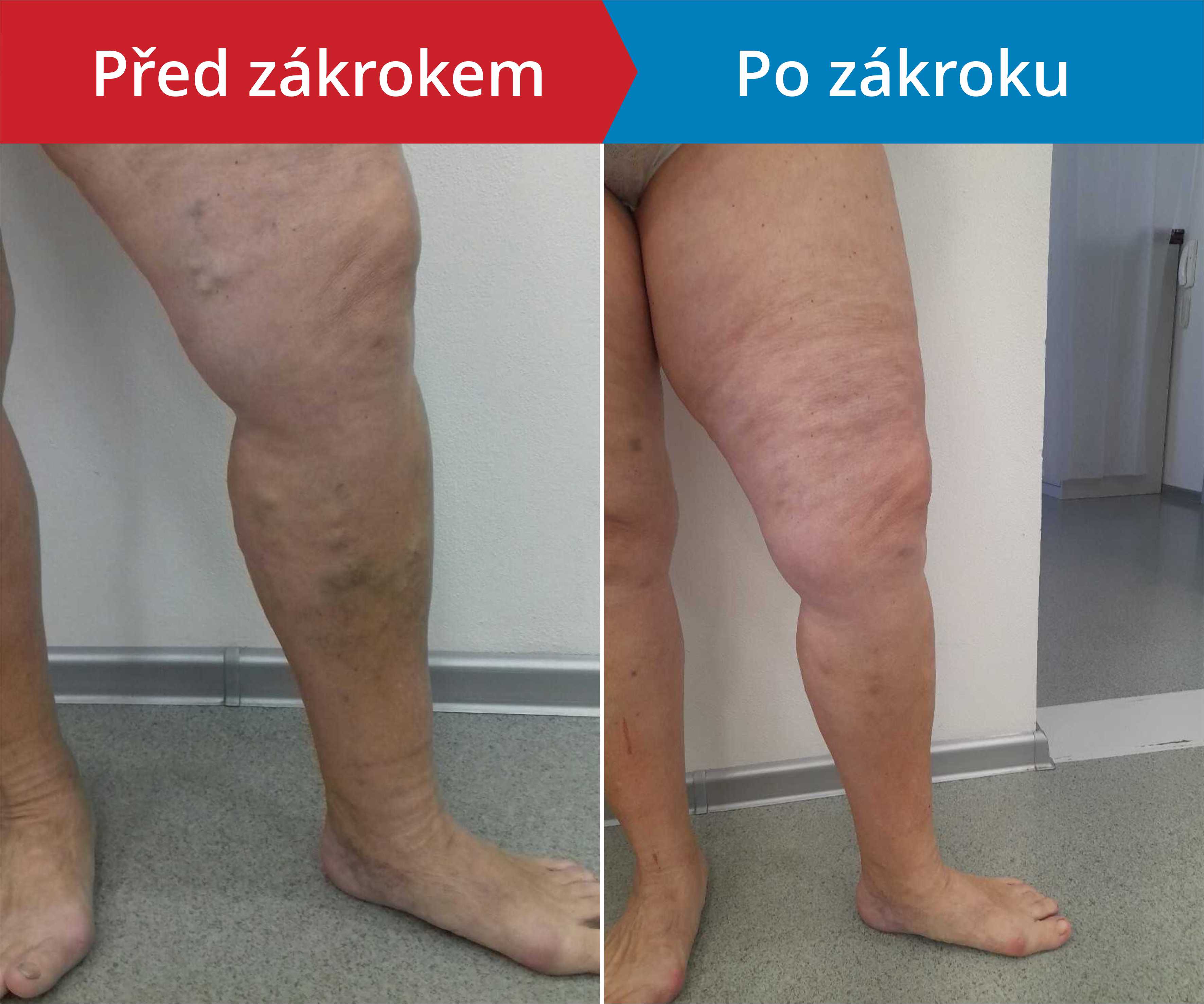 Načítám foto