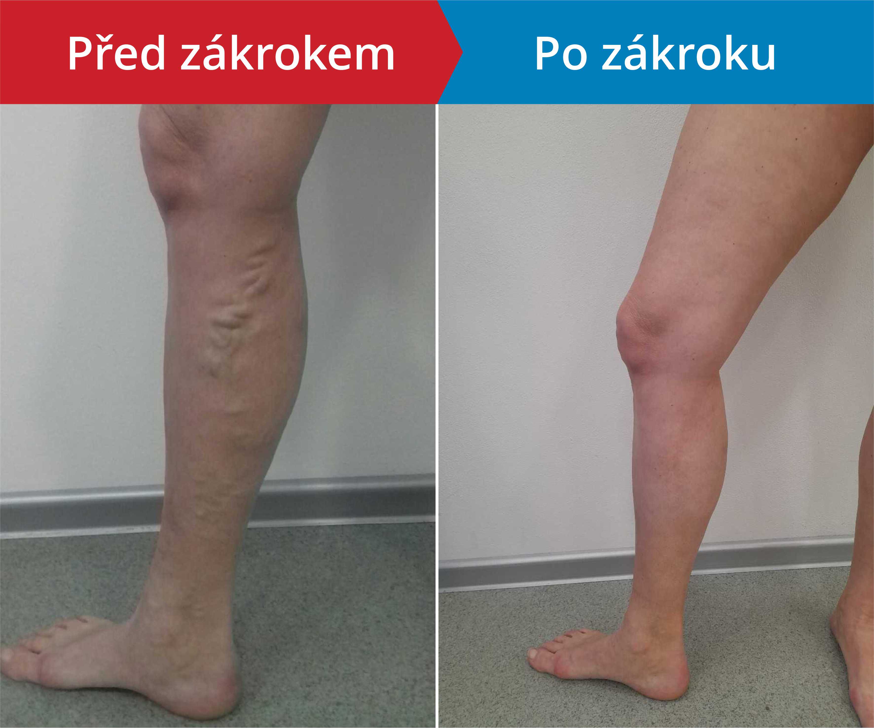 Načítám foto