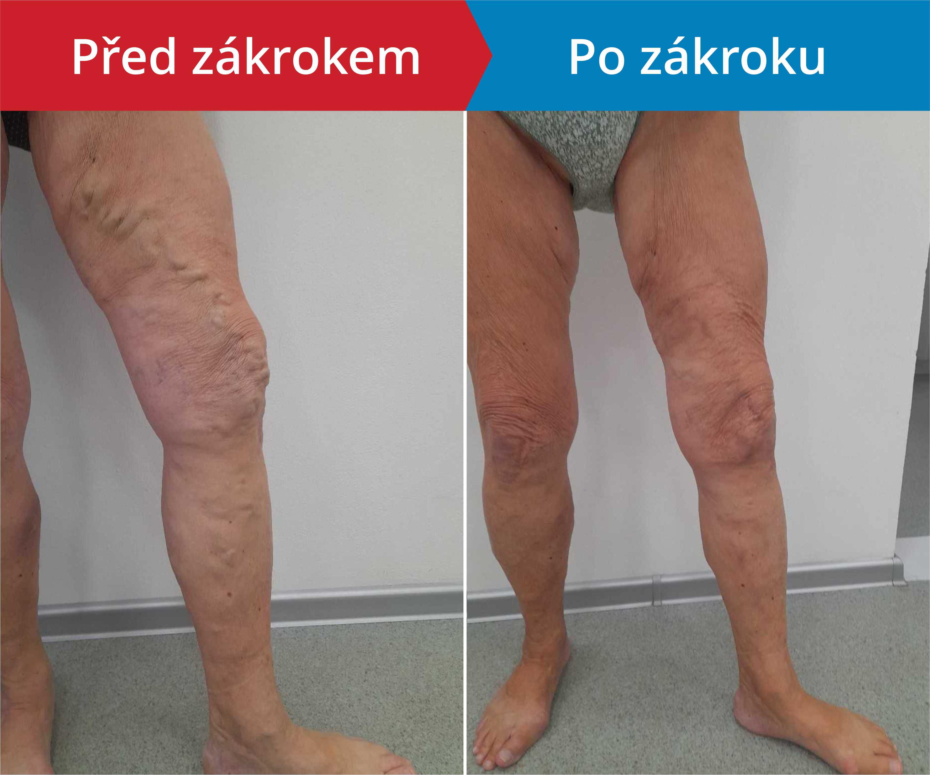 Načítám foto