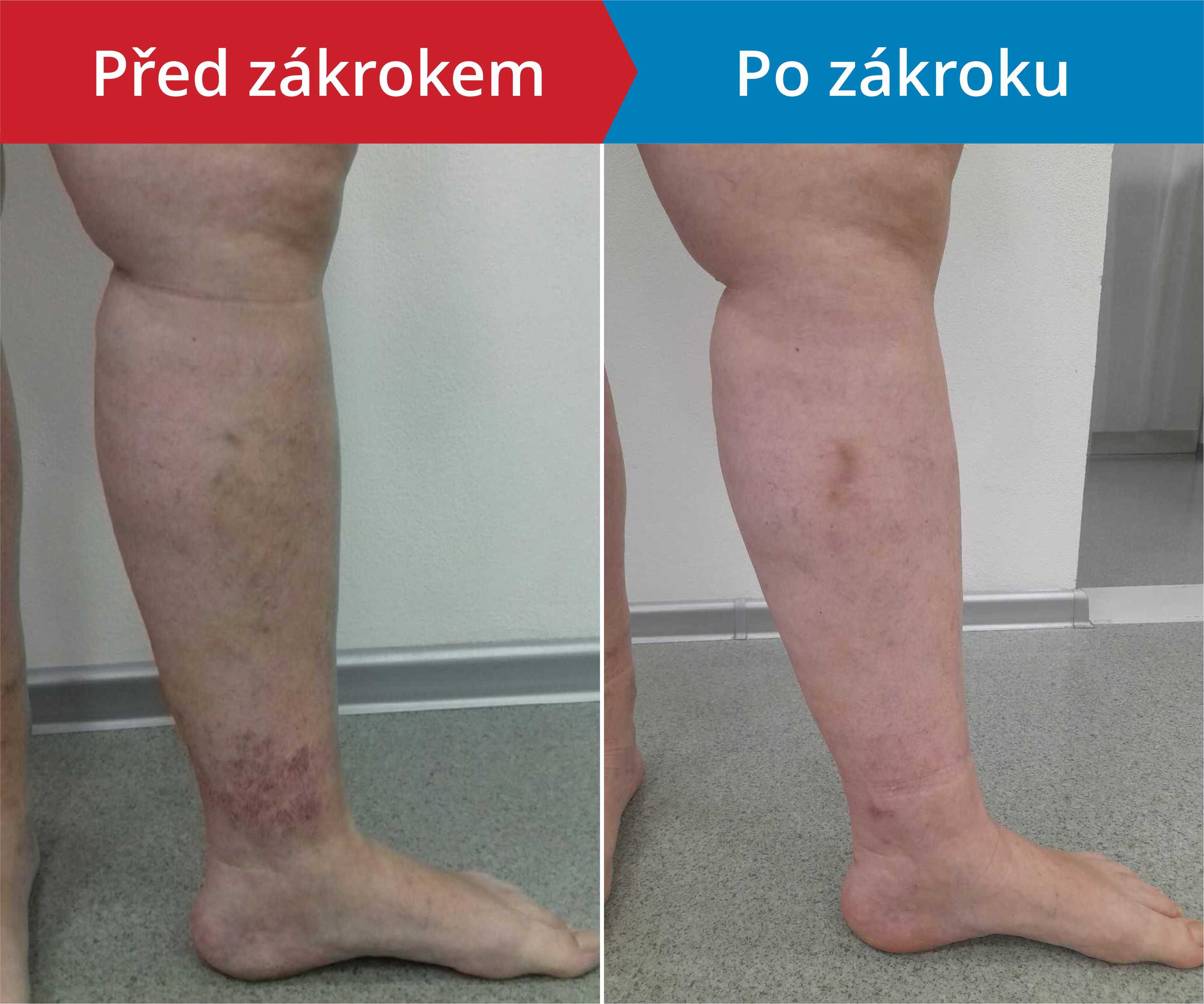 Načítám foto