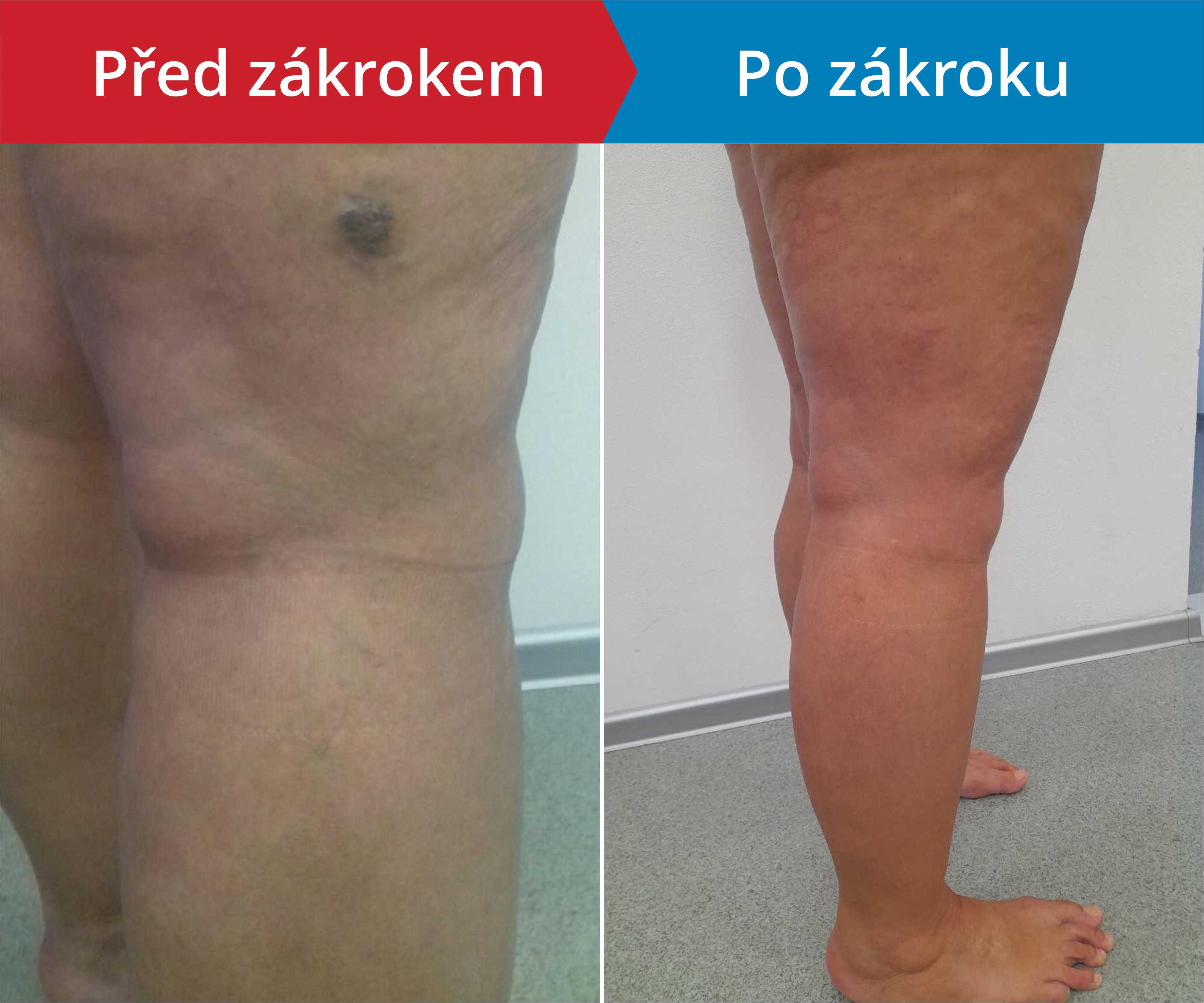Načítám foto