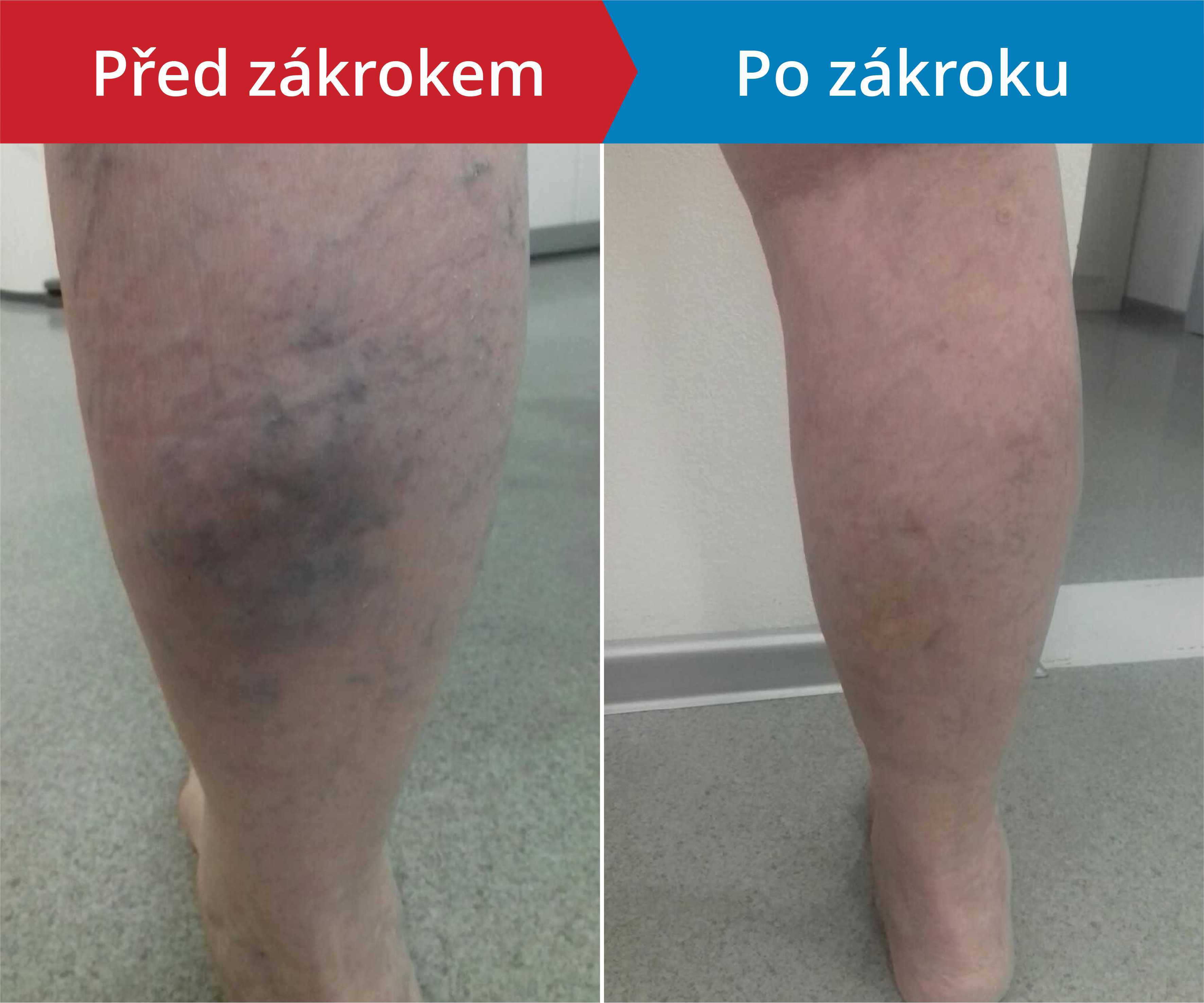 Načítám foto