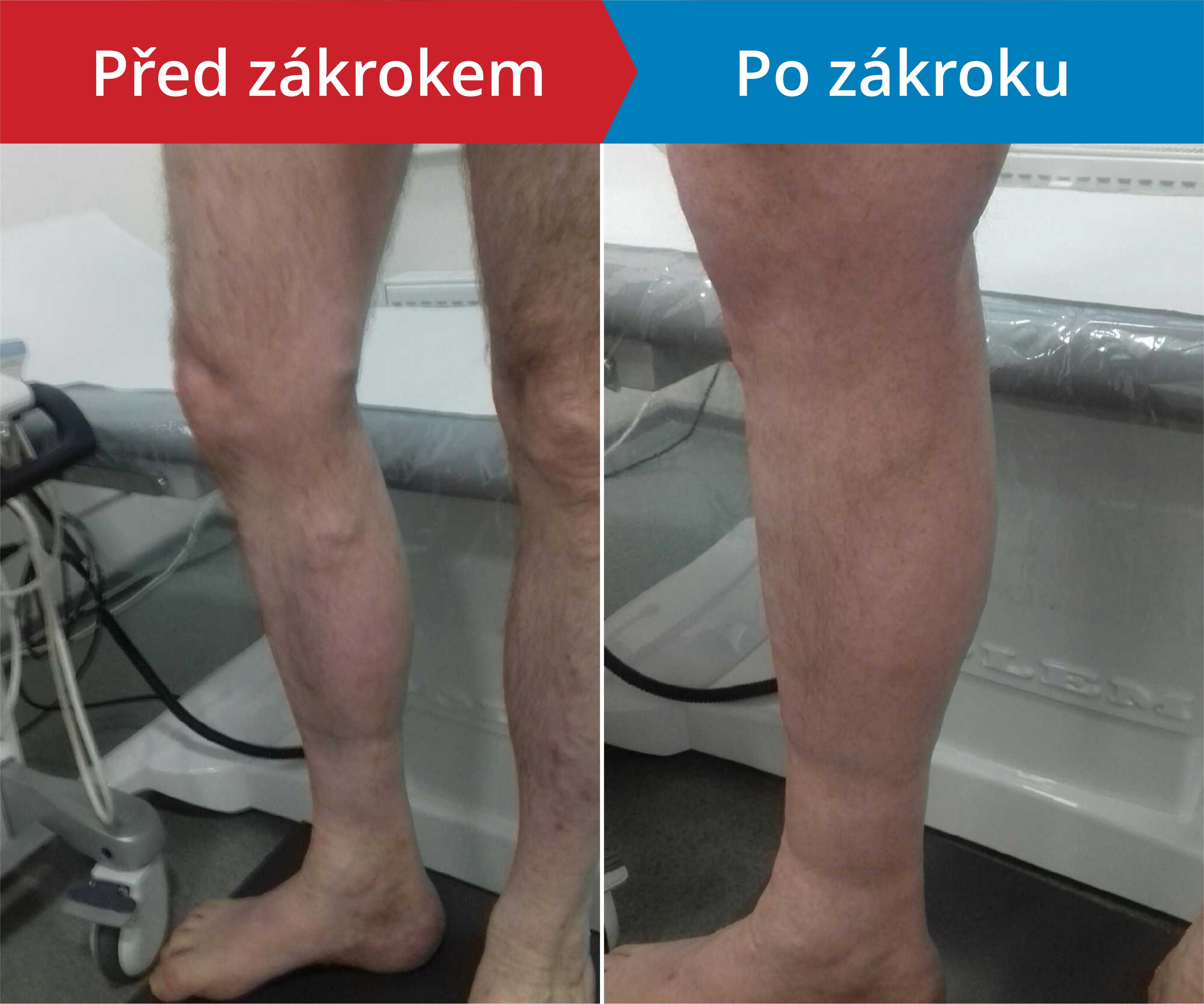 Načítám foto