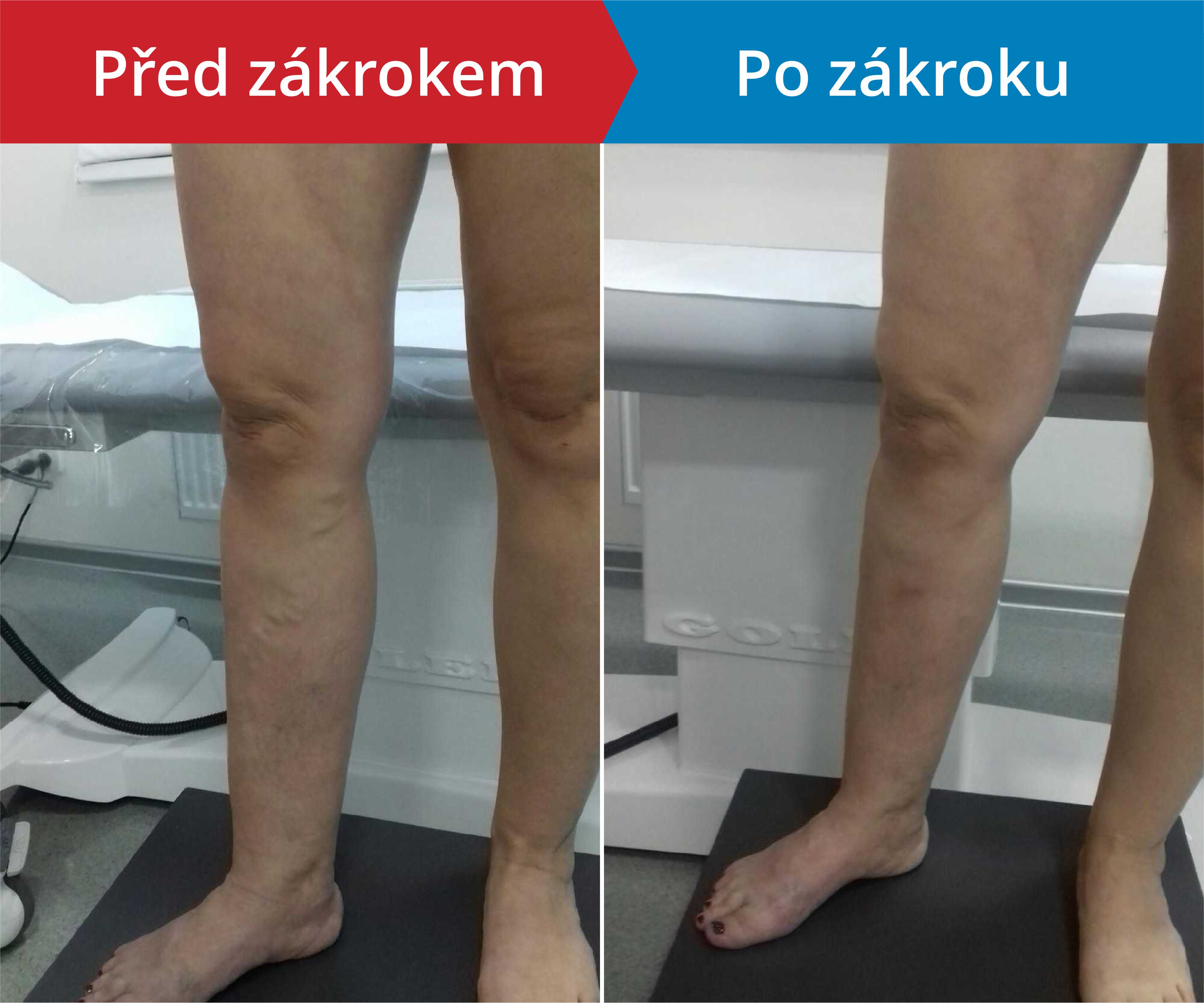 Načítám foto