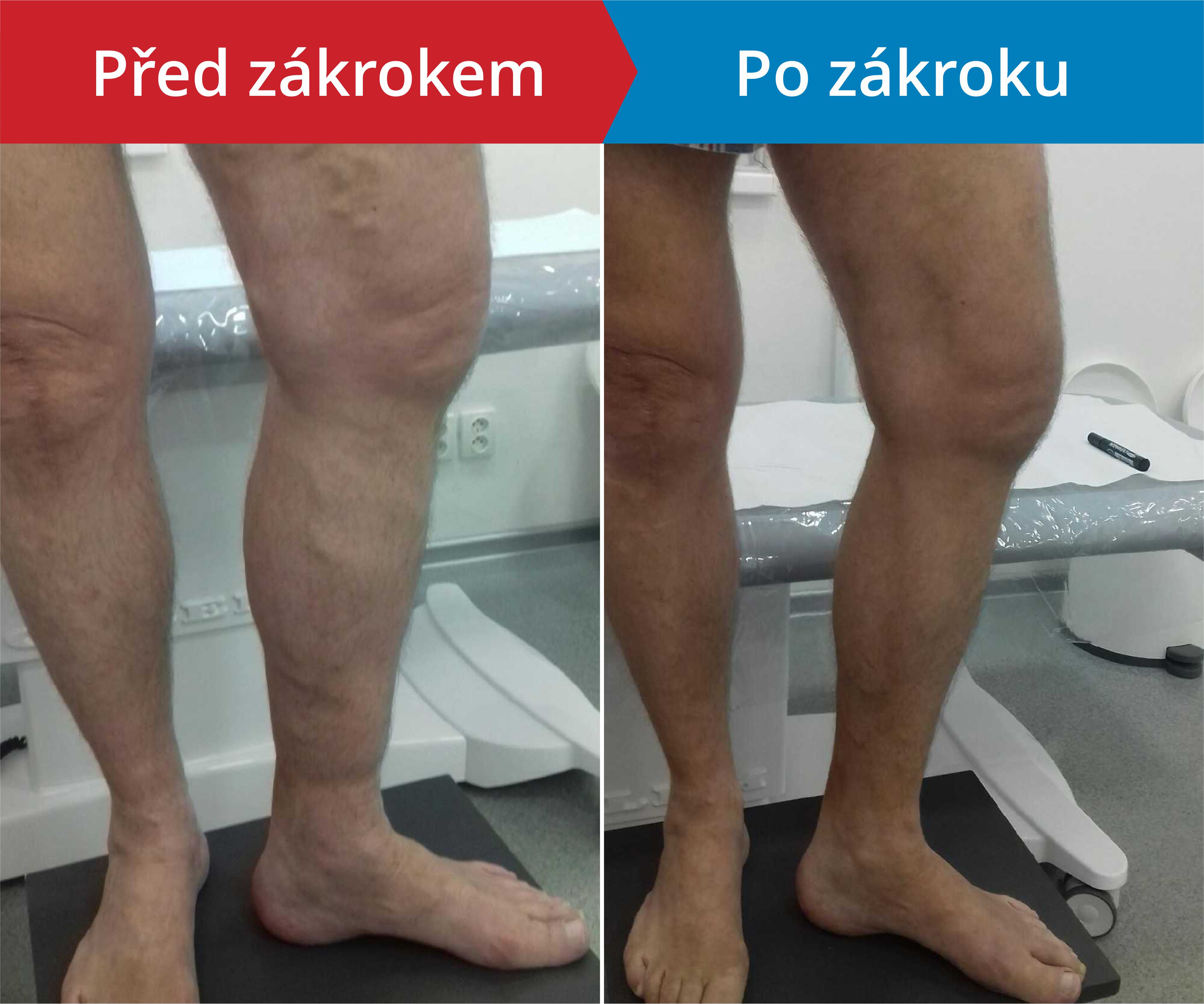 Načítám foto
