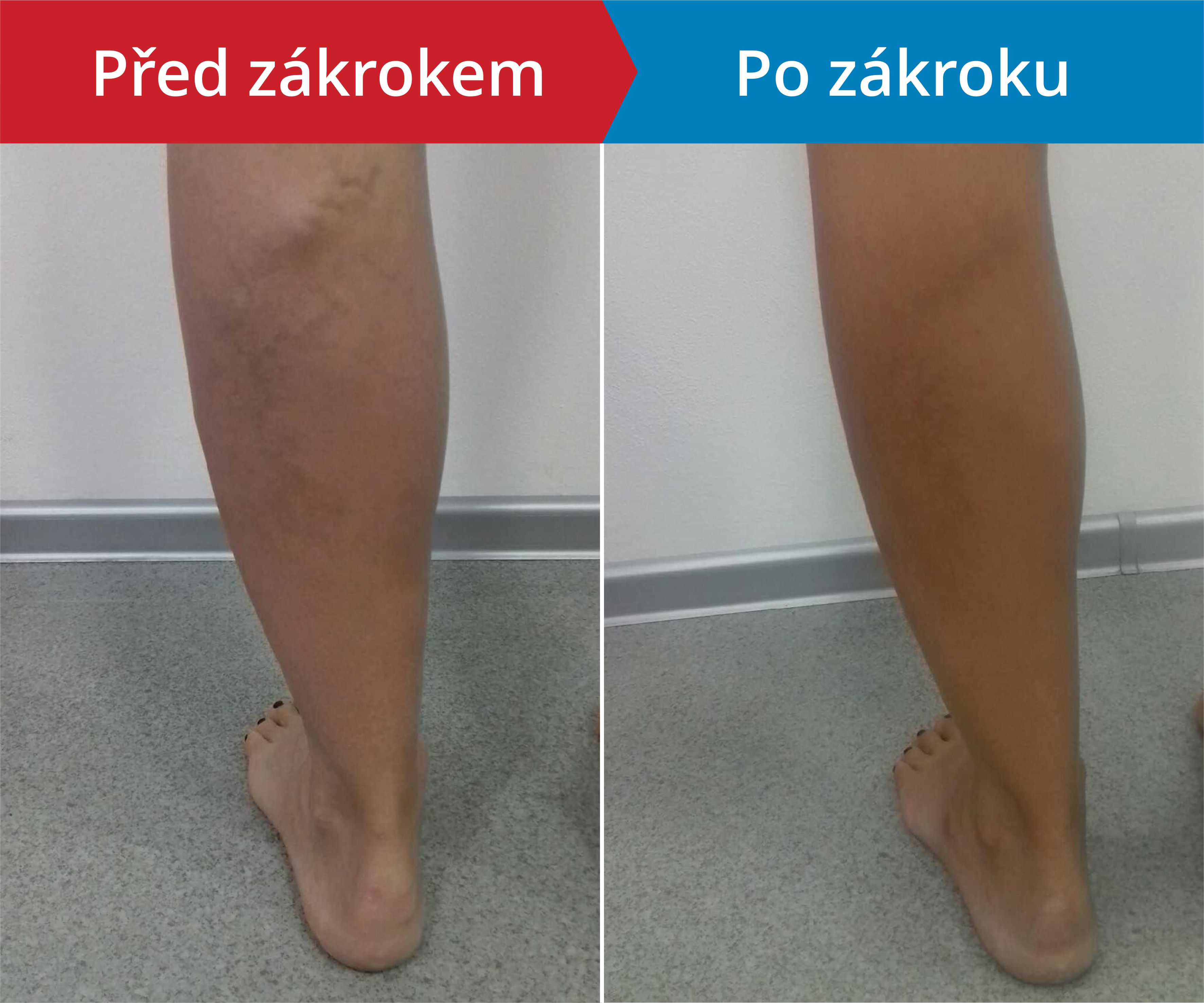 Načítám foto