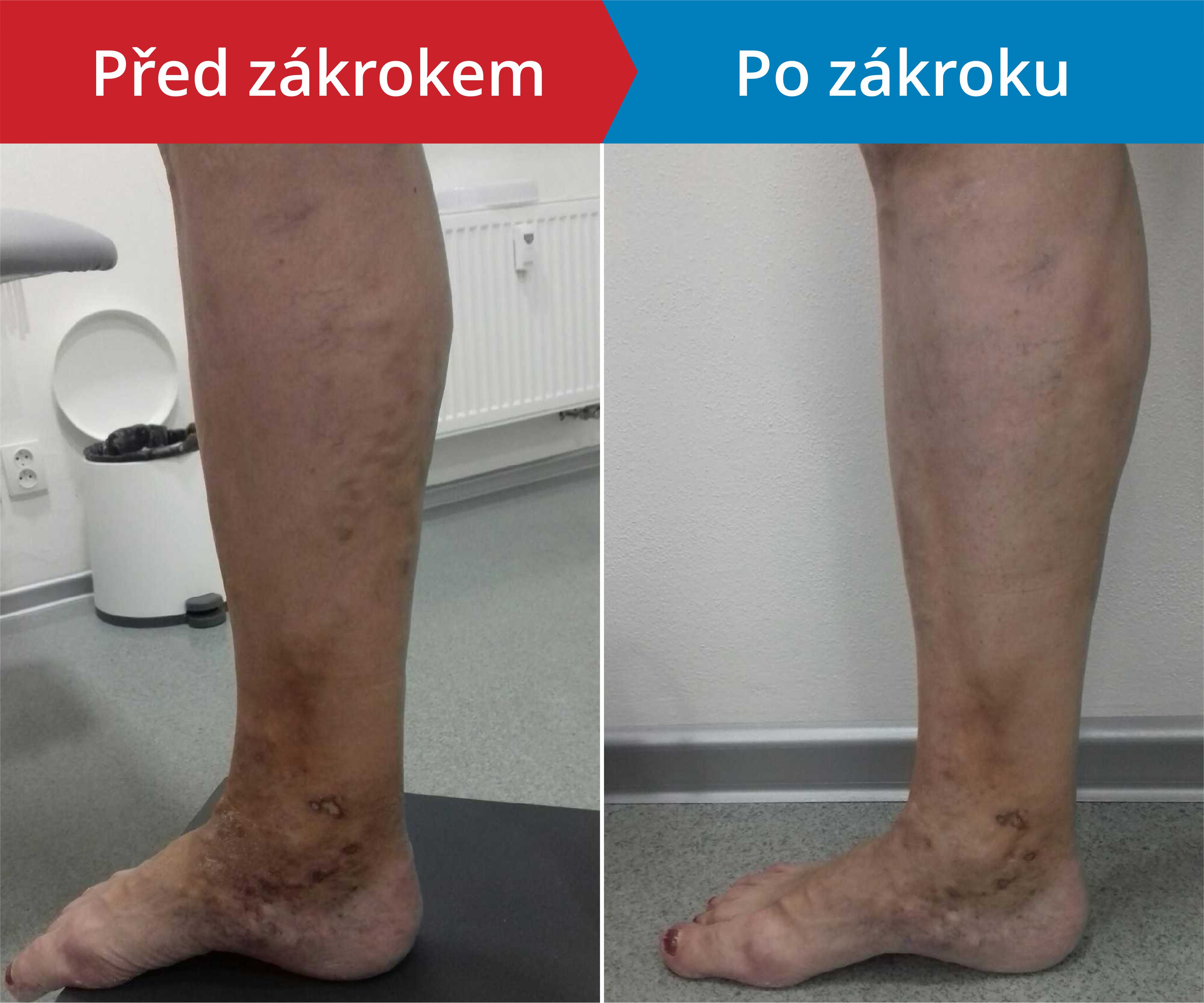 Načítám foto