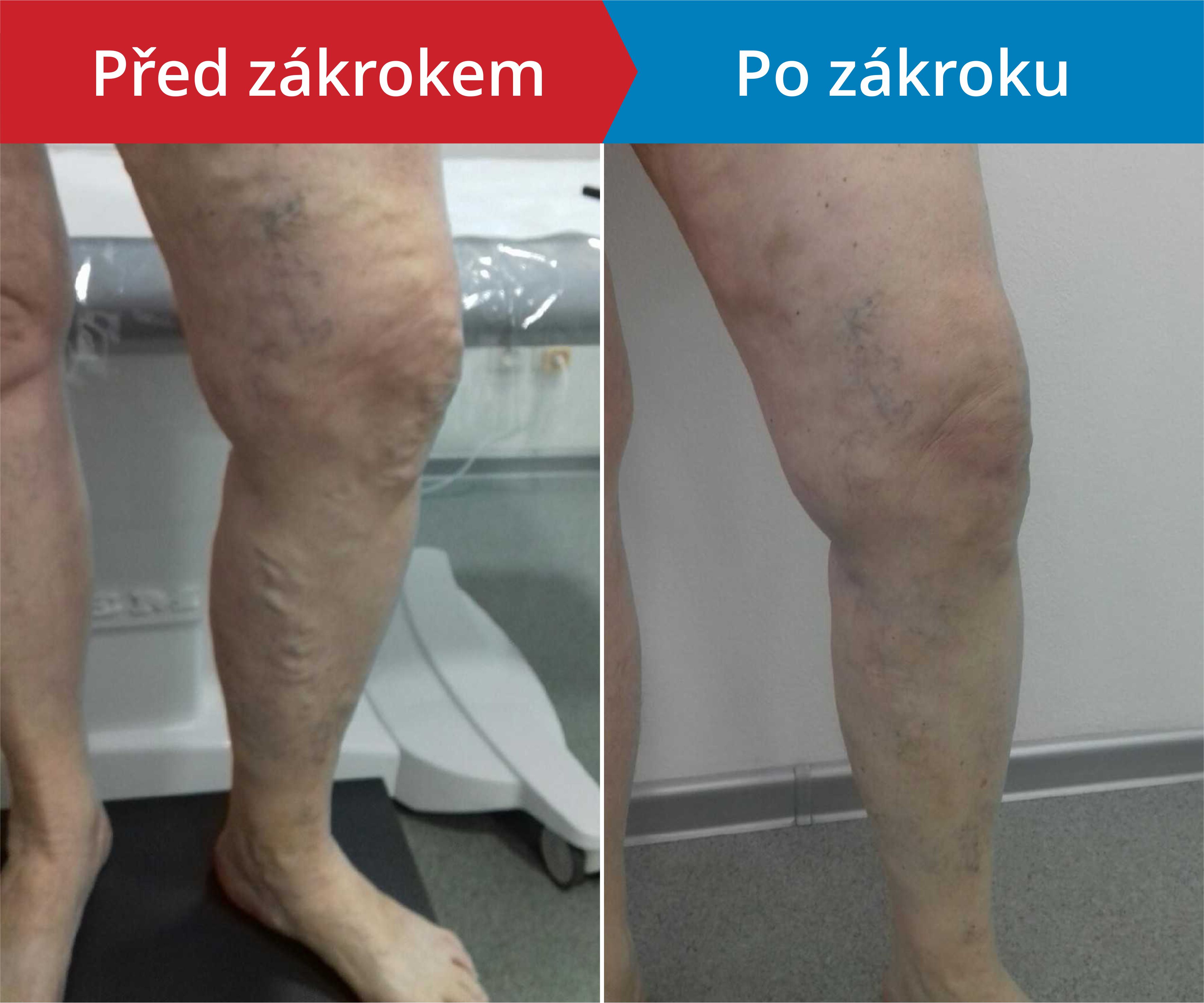 Načítám foto