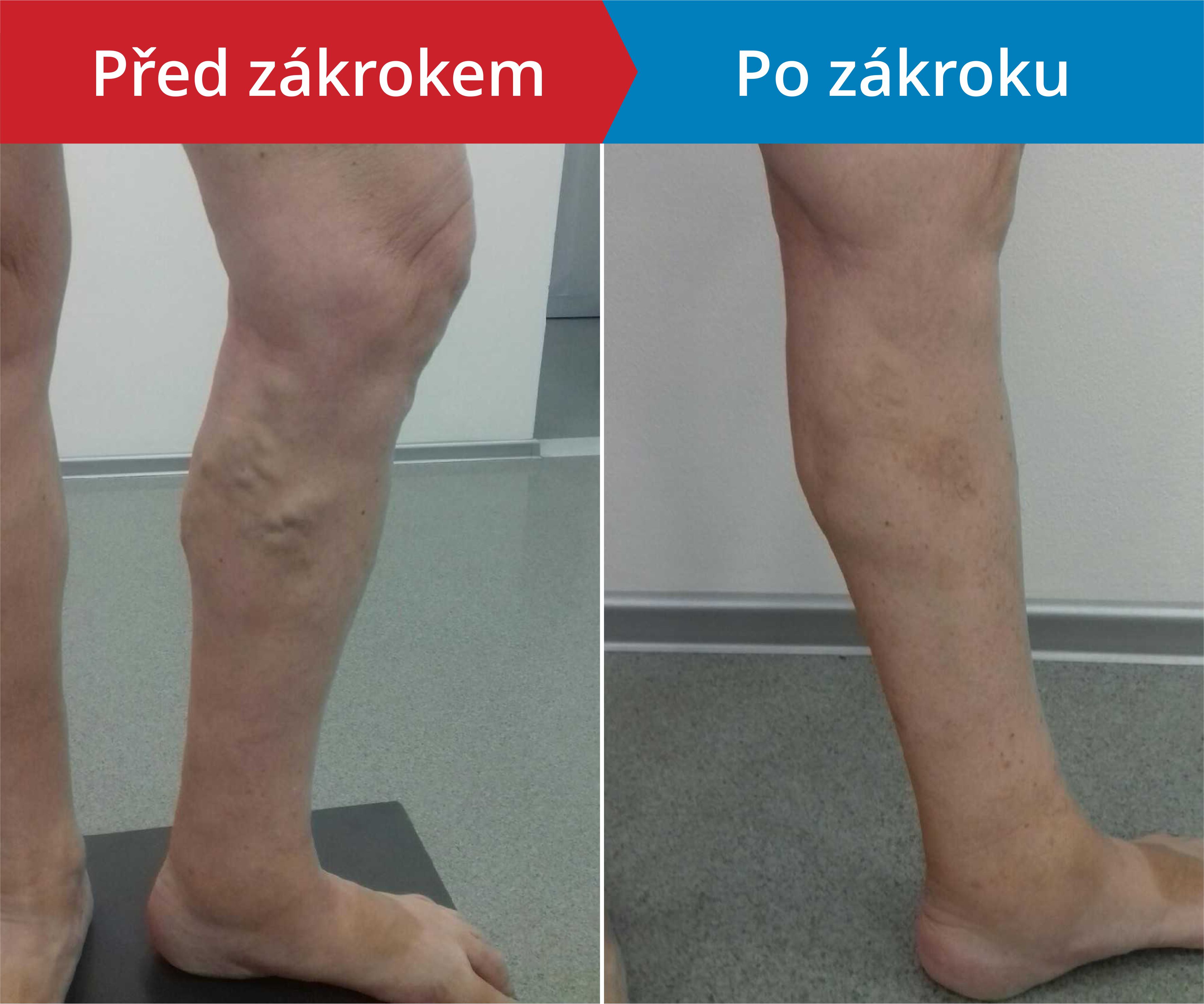 Načítám foto