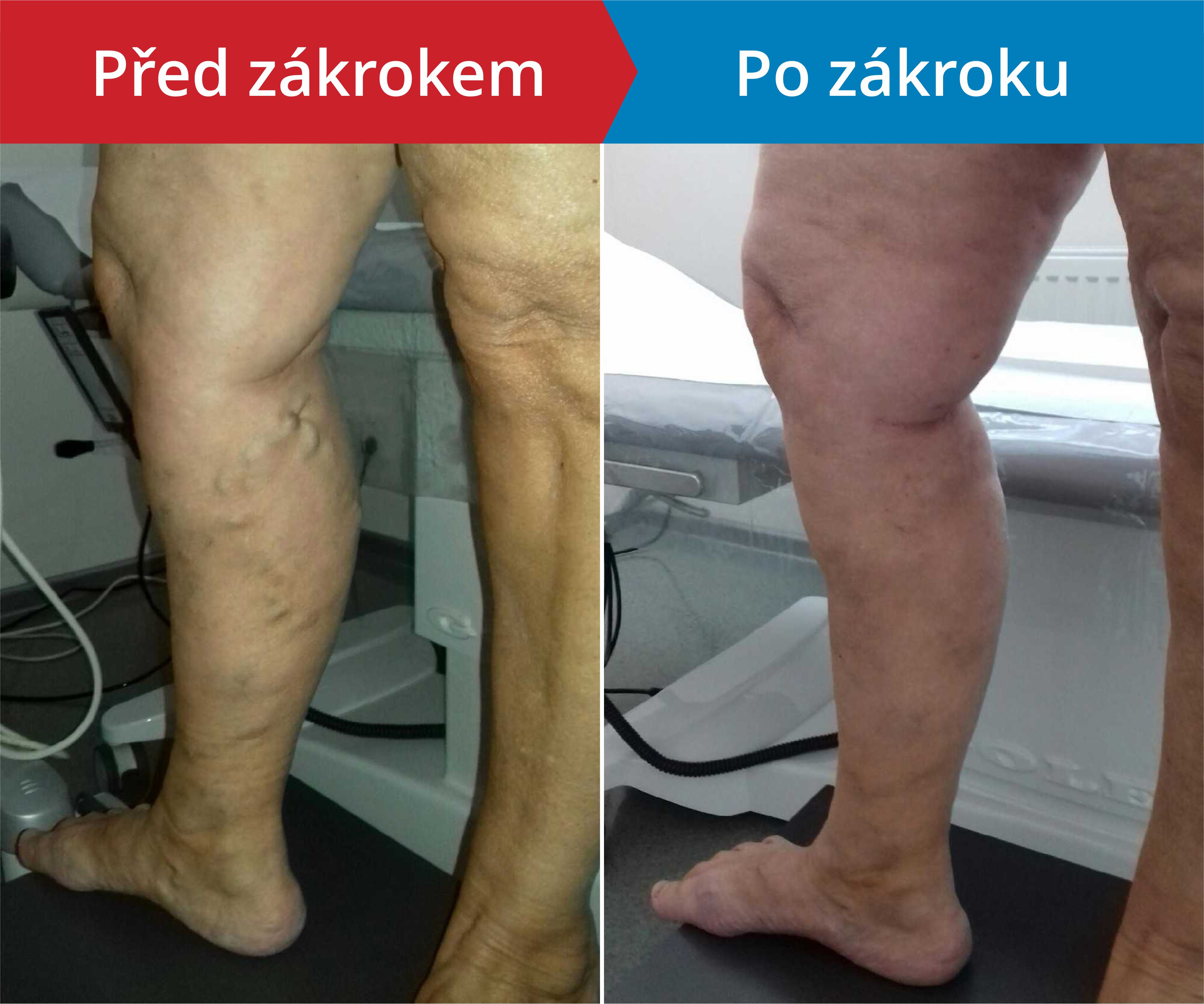 Načítám foto