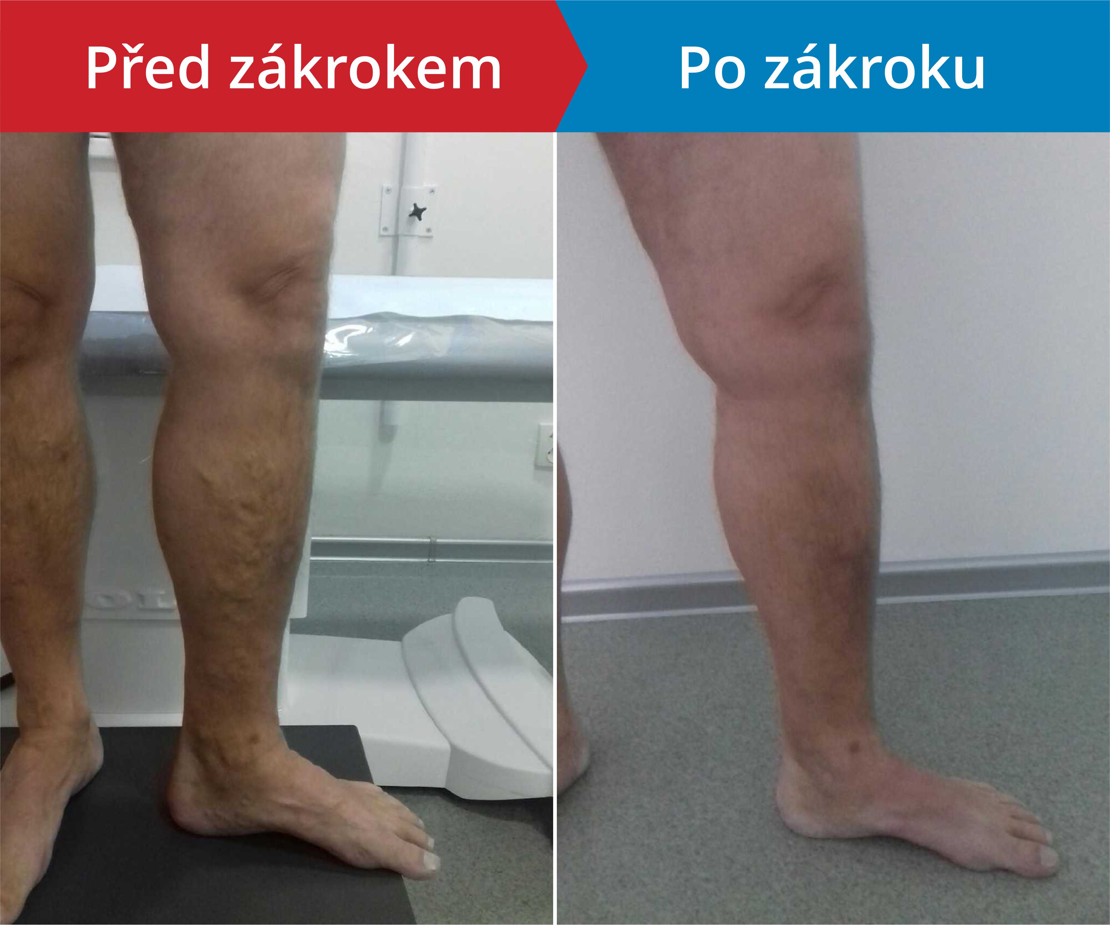 Načítám foto