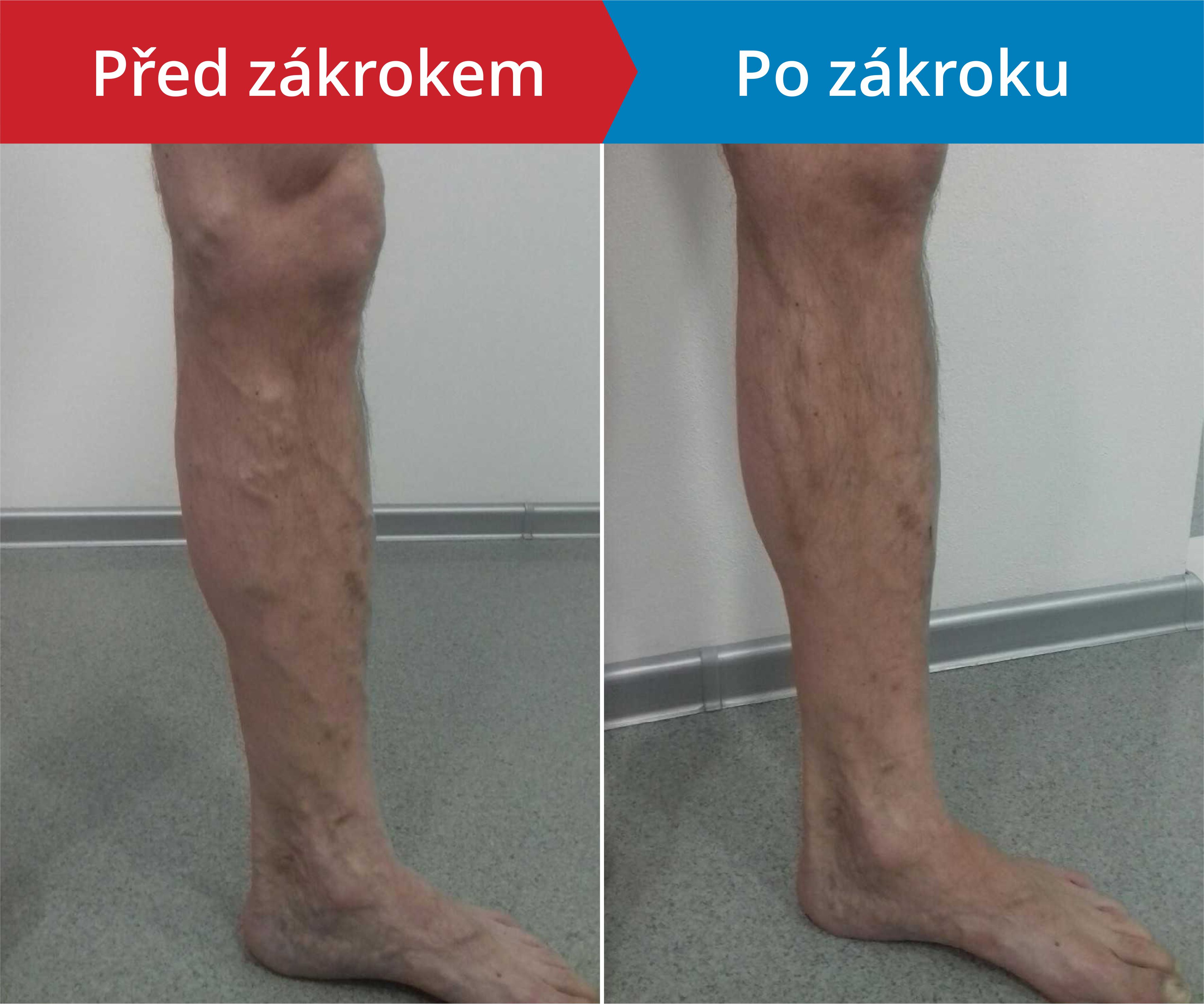 Načítám foto