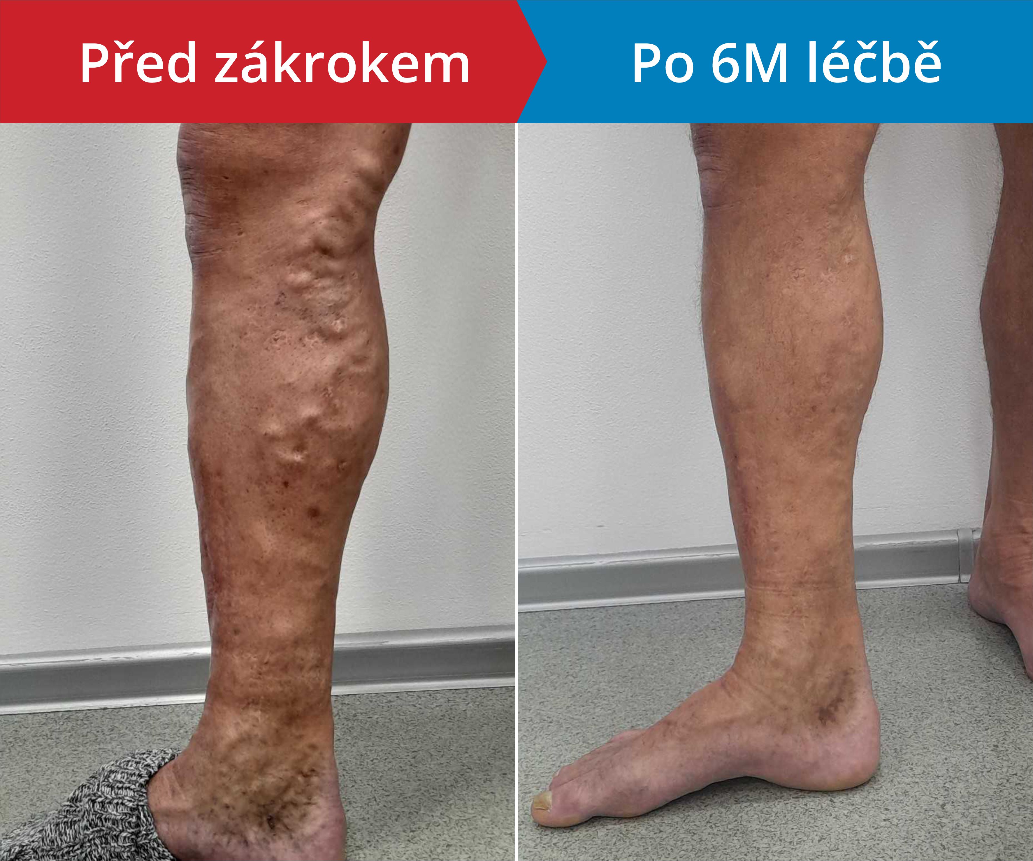 Načítám foto