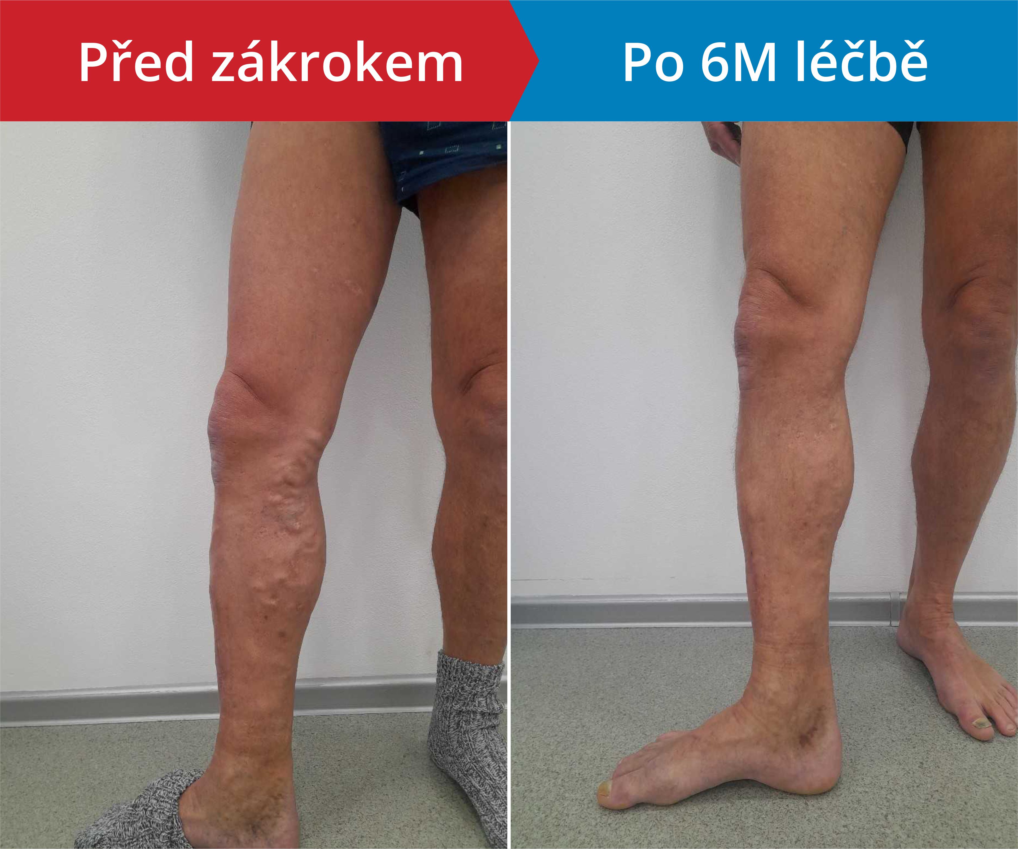 Načítám foto