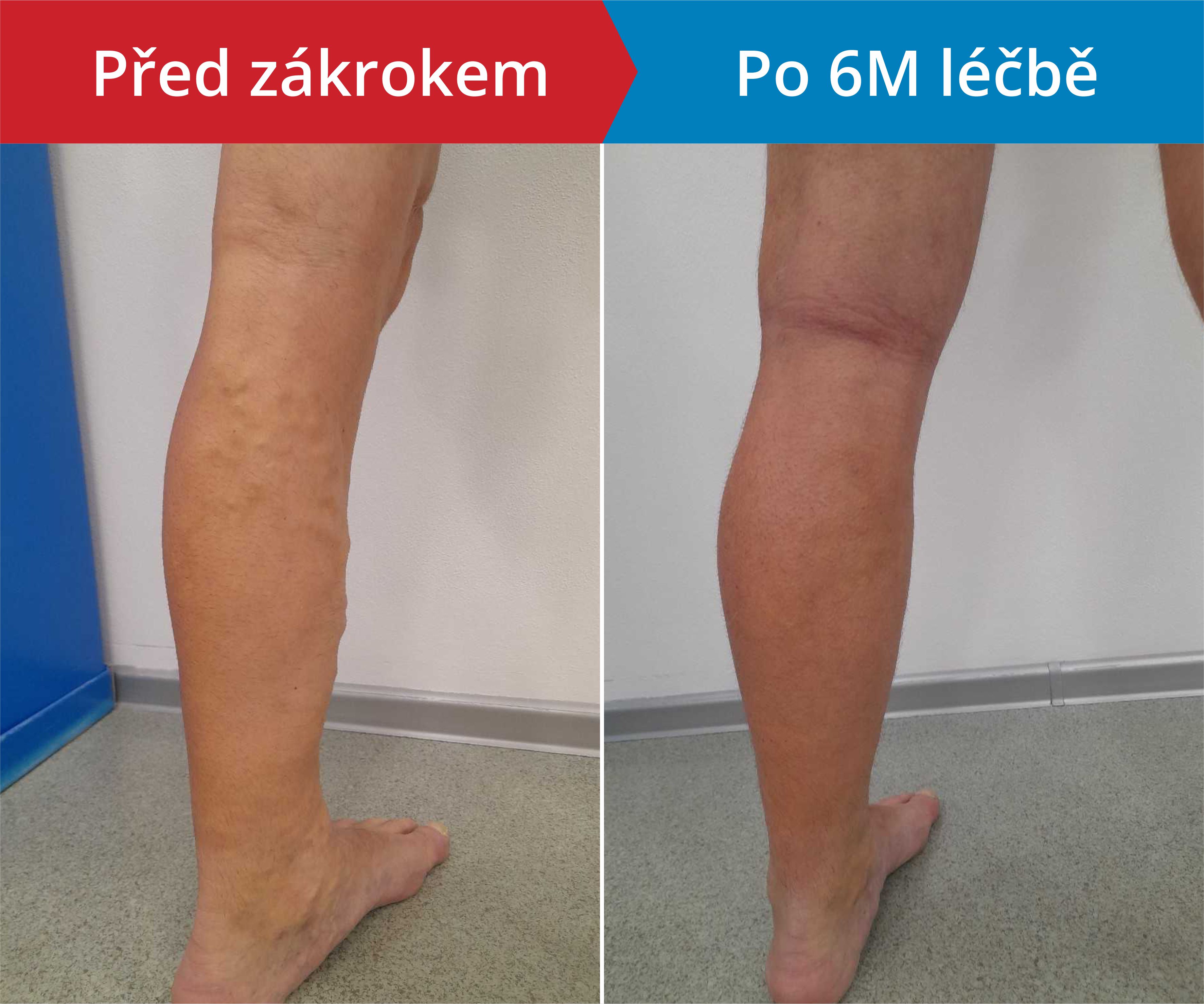 Načítám foto