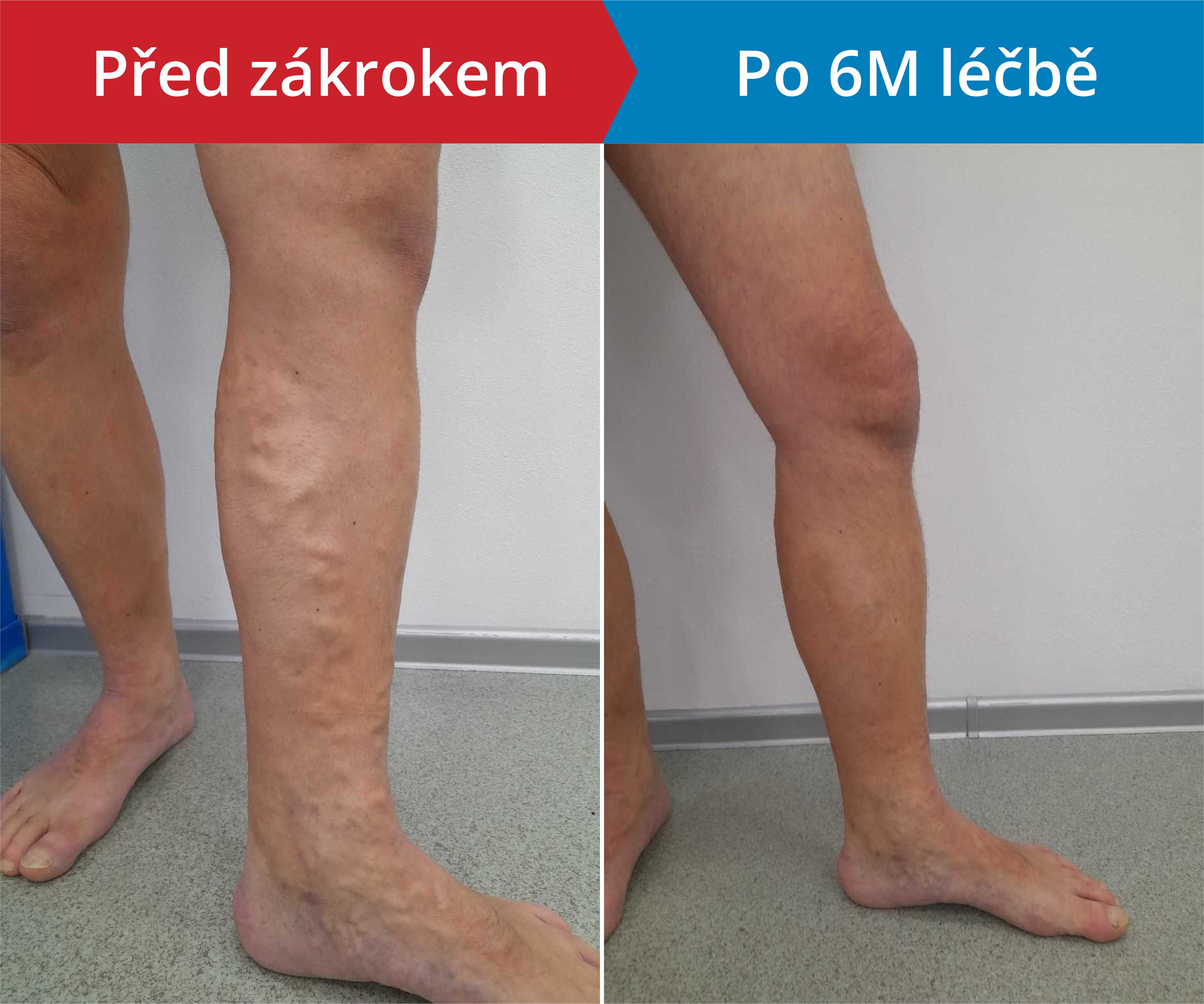 Načítám foto