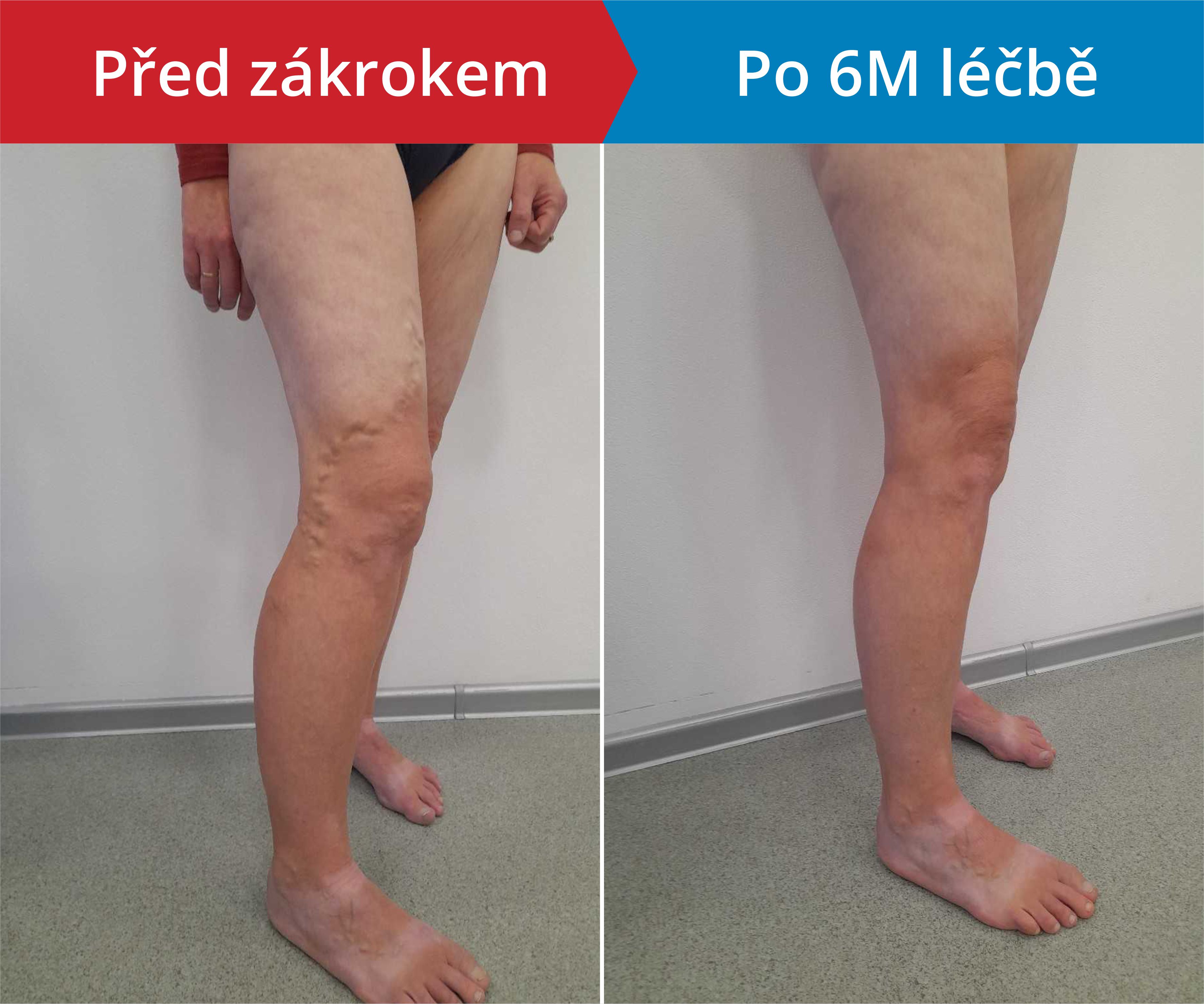Načítám foto