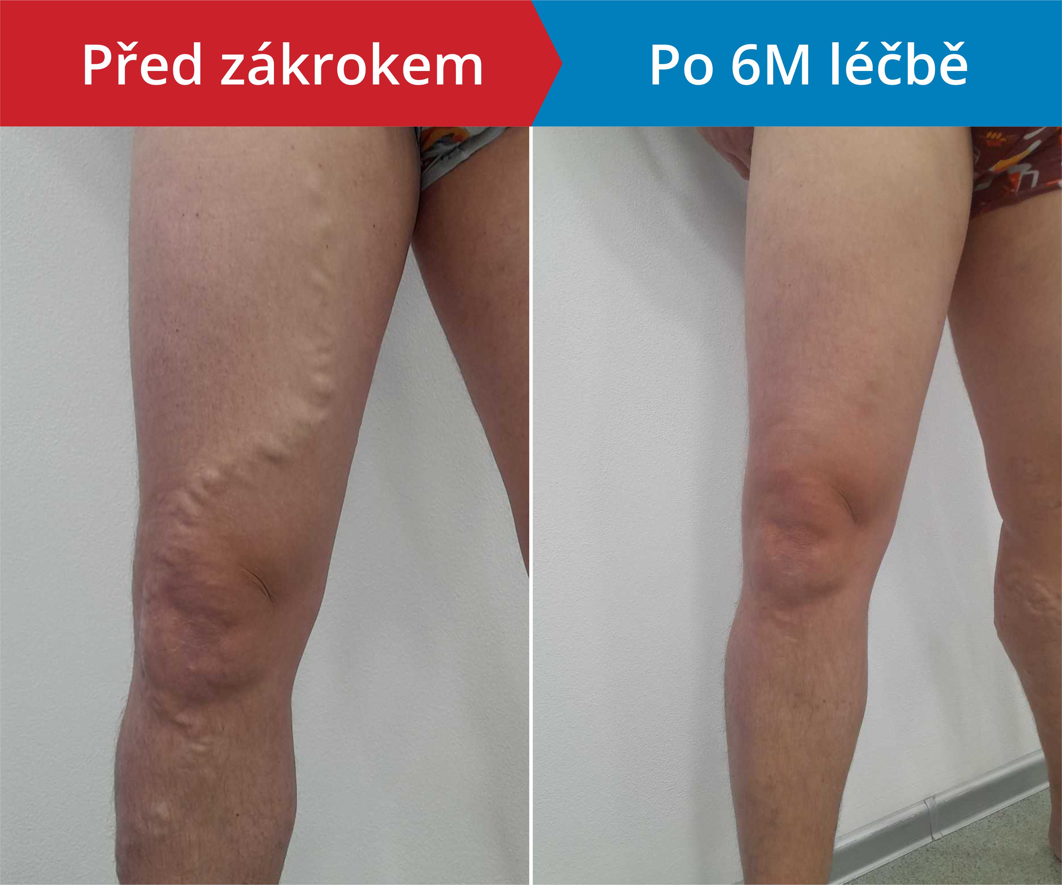 Načítám foto