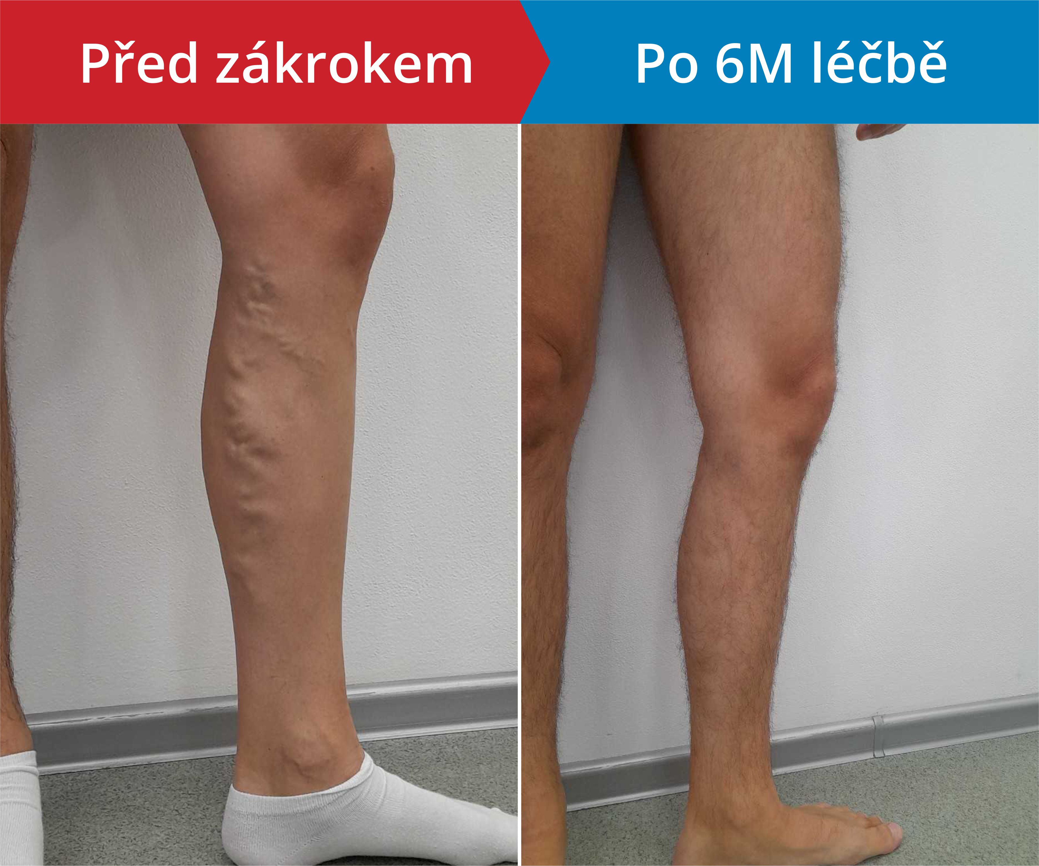 Načítám foto
